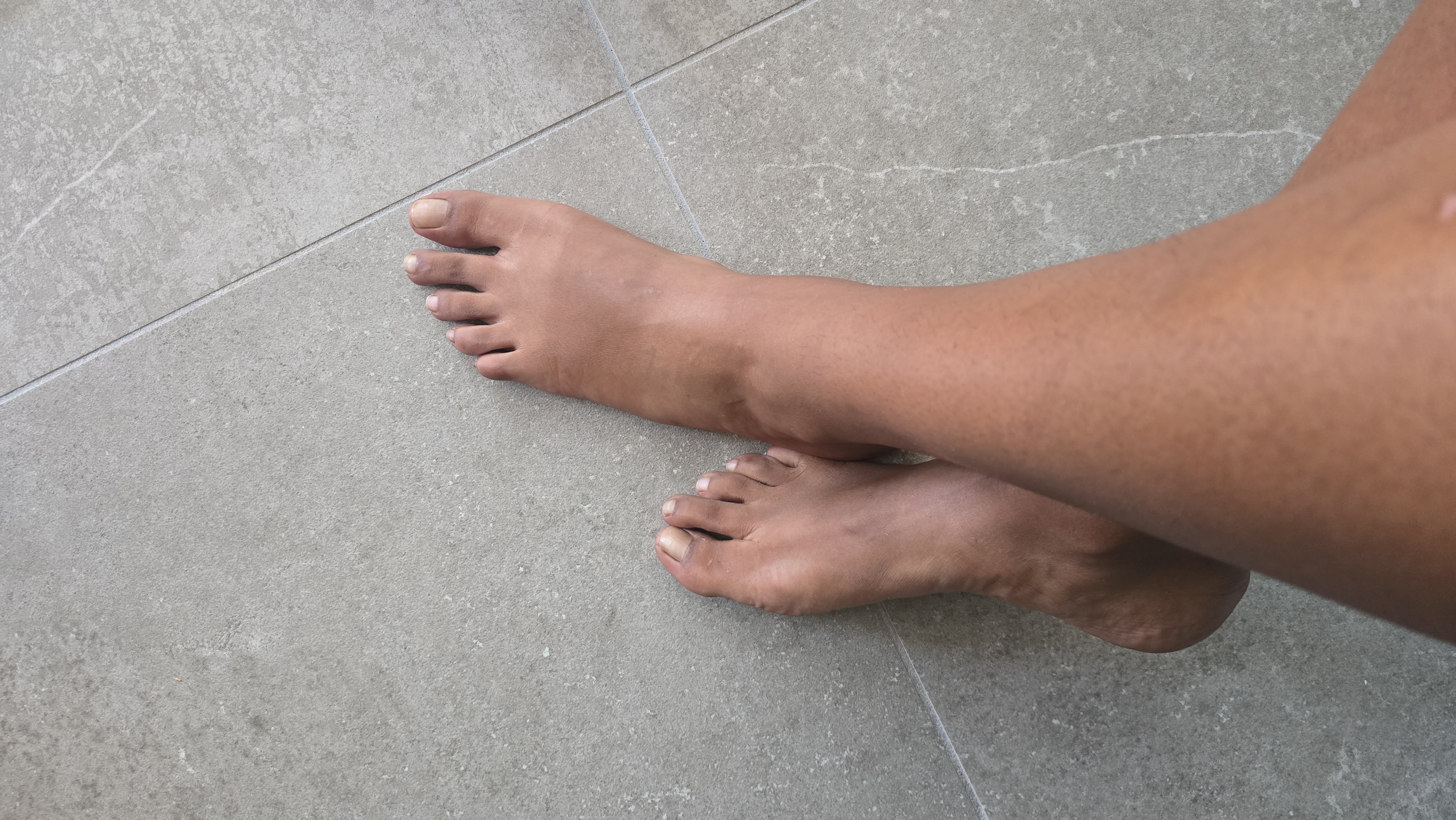 @pied_ensoleille